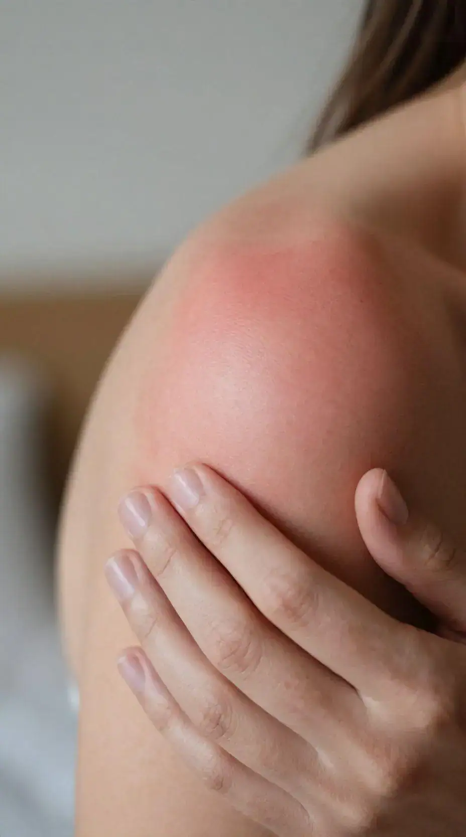 Sua pele estranha? Descubra o verdadeiro vilão por trás da coceira!