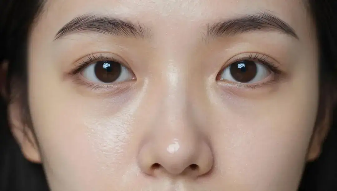 Você não vai acreditar no segredo para uma pele hidratada sem brilho!