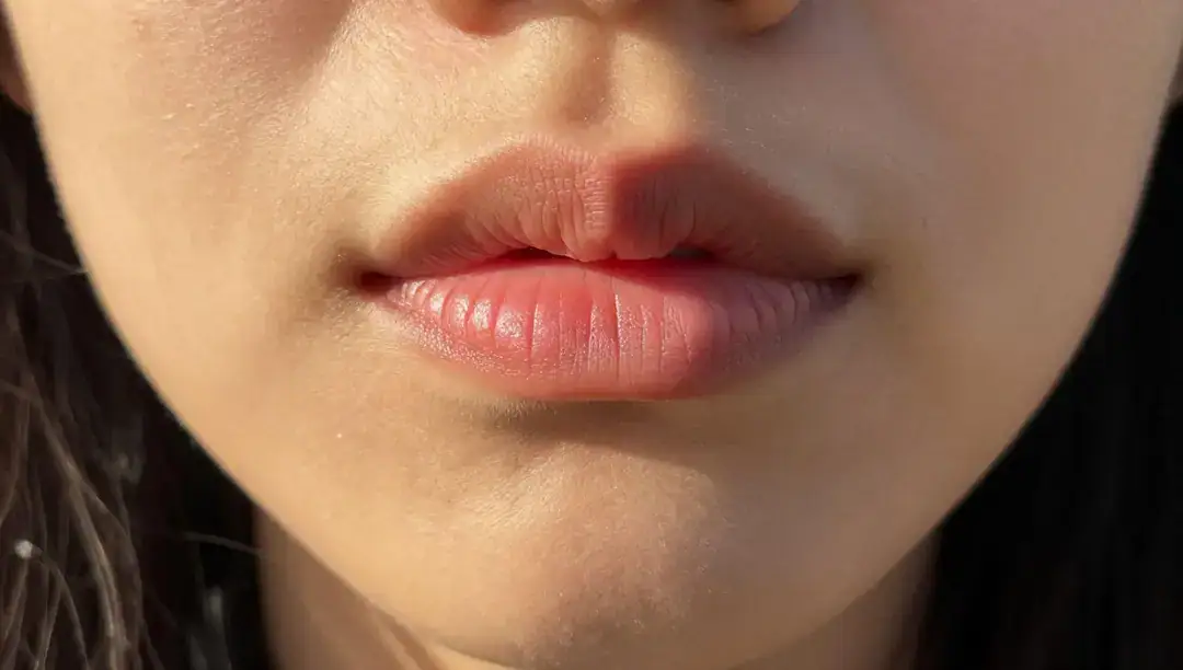 O erro que está prejudicando seus lábios — e quase ninguém te conta!