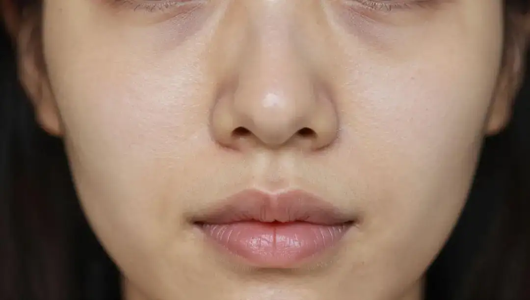 Você não vai acreditar no segredo contra manchas!